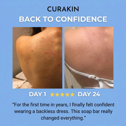 Curakin - Bacne Soap