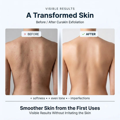 Curakin Exfoliating Shower Towel