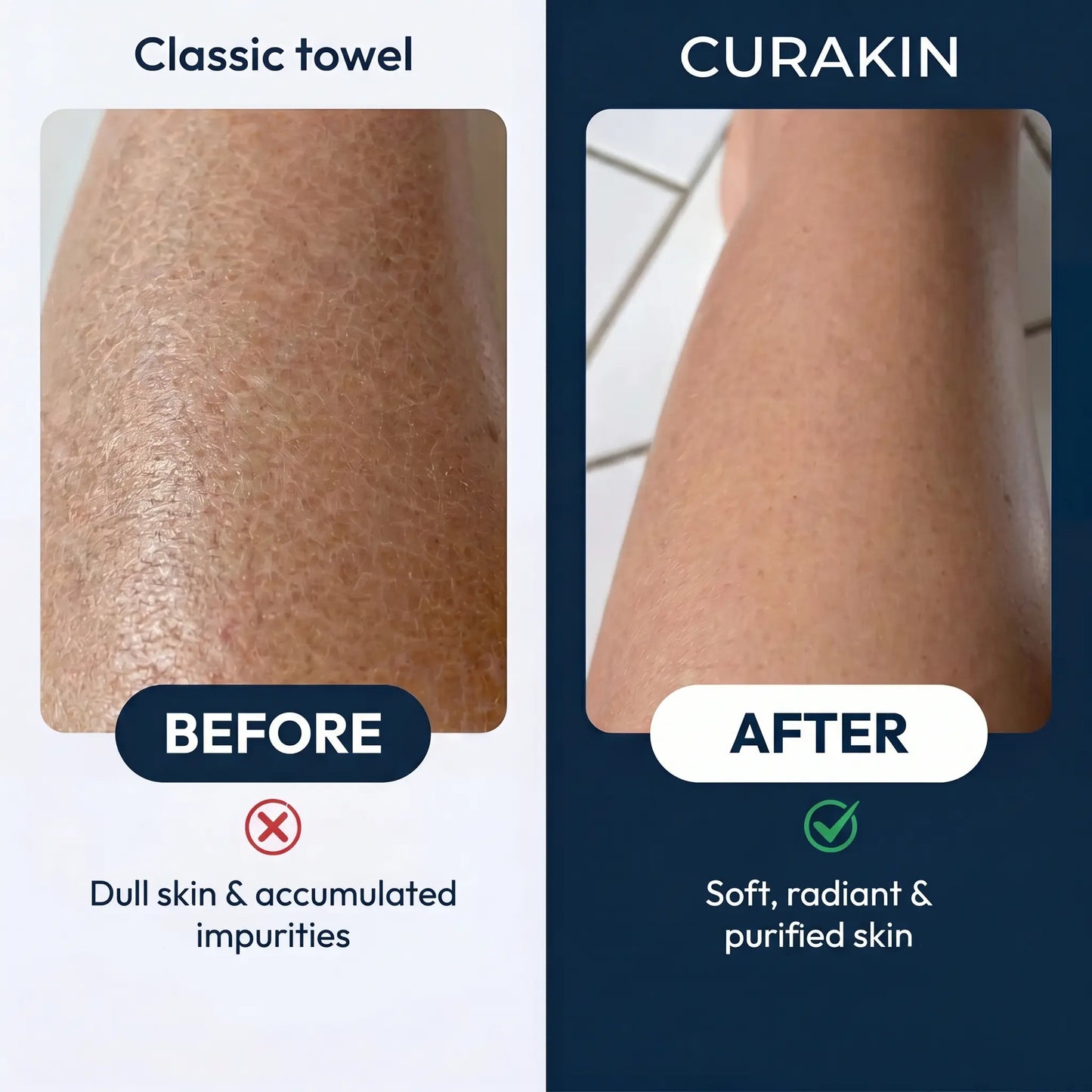 Curakin Exfoliating Shower Towel