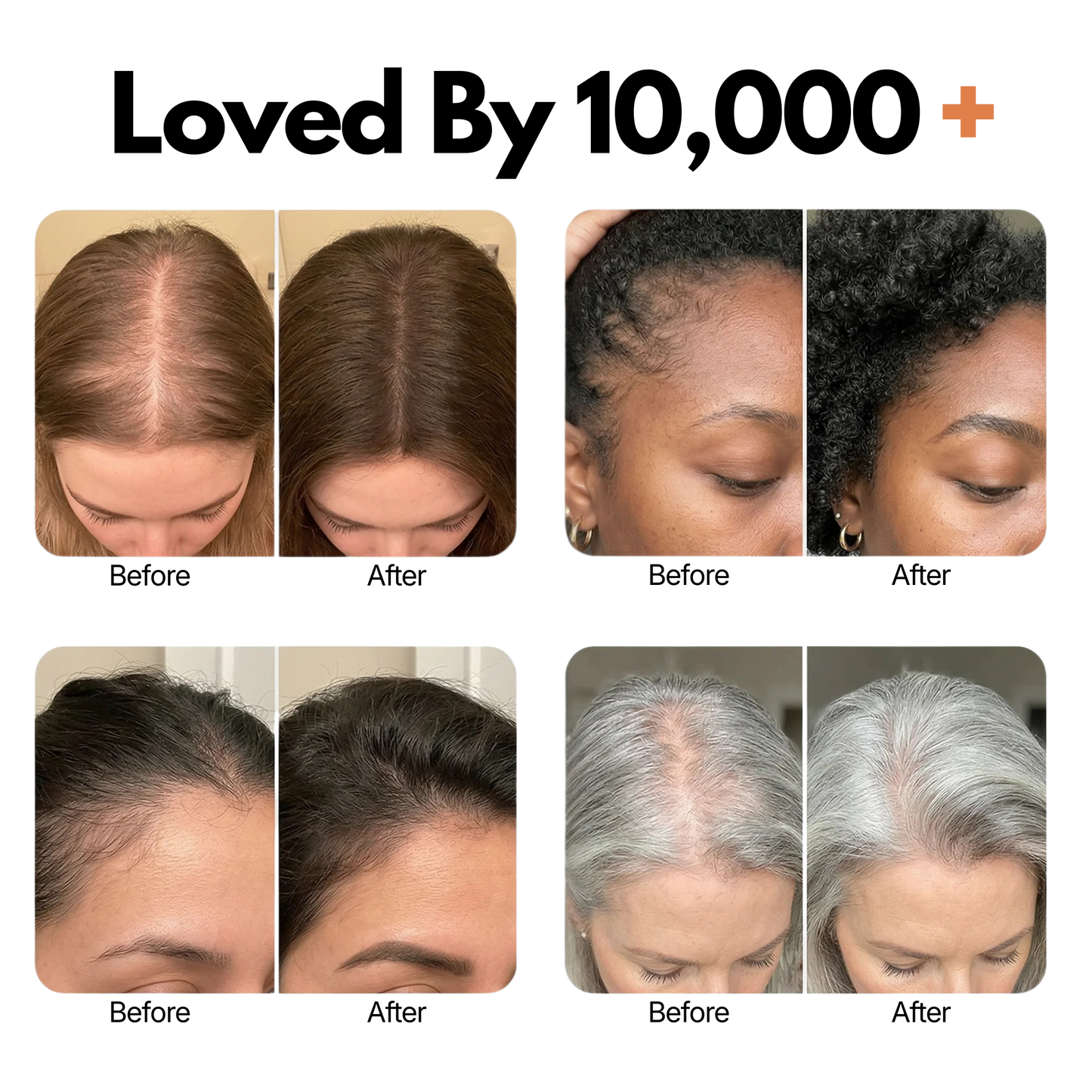 Curakin Grow - Korea's #1 Hair Growth Serum