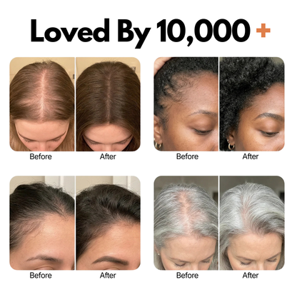 Curakin Grow - Korea's #1 Hair Growth Serum